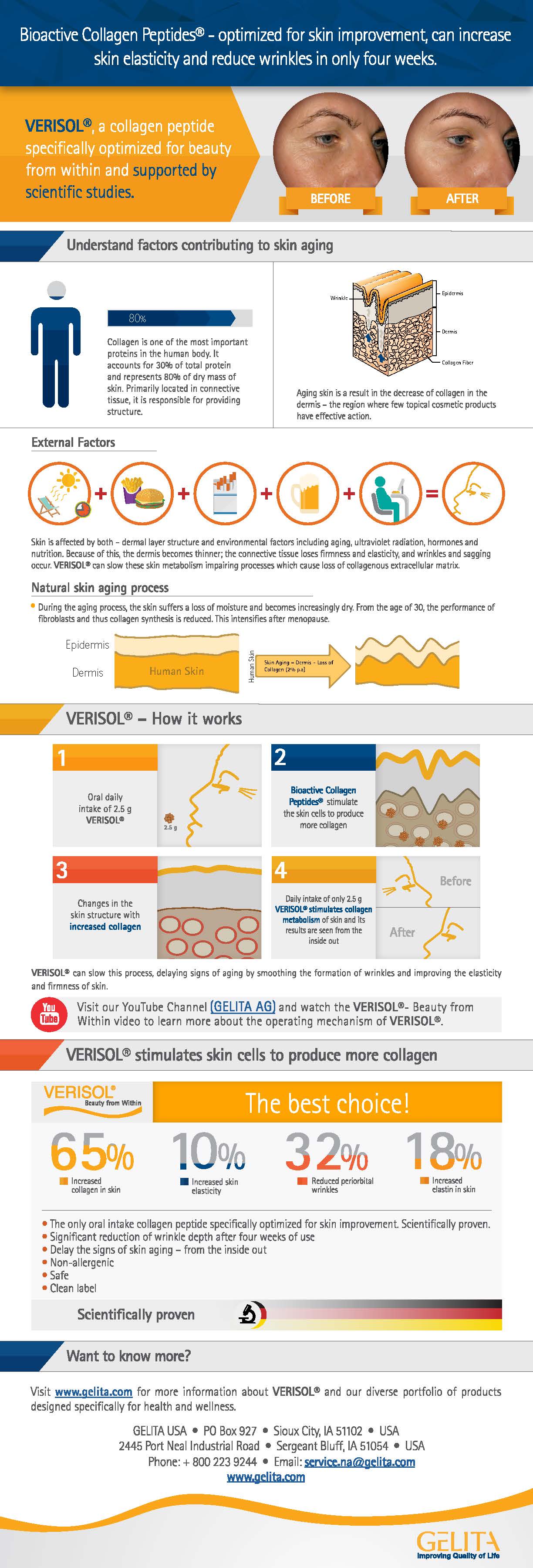 VERISOL® - Infográfico (Inglês)