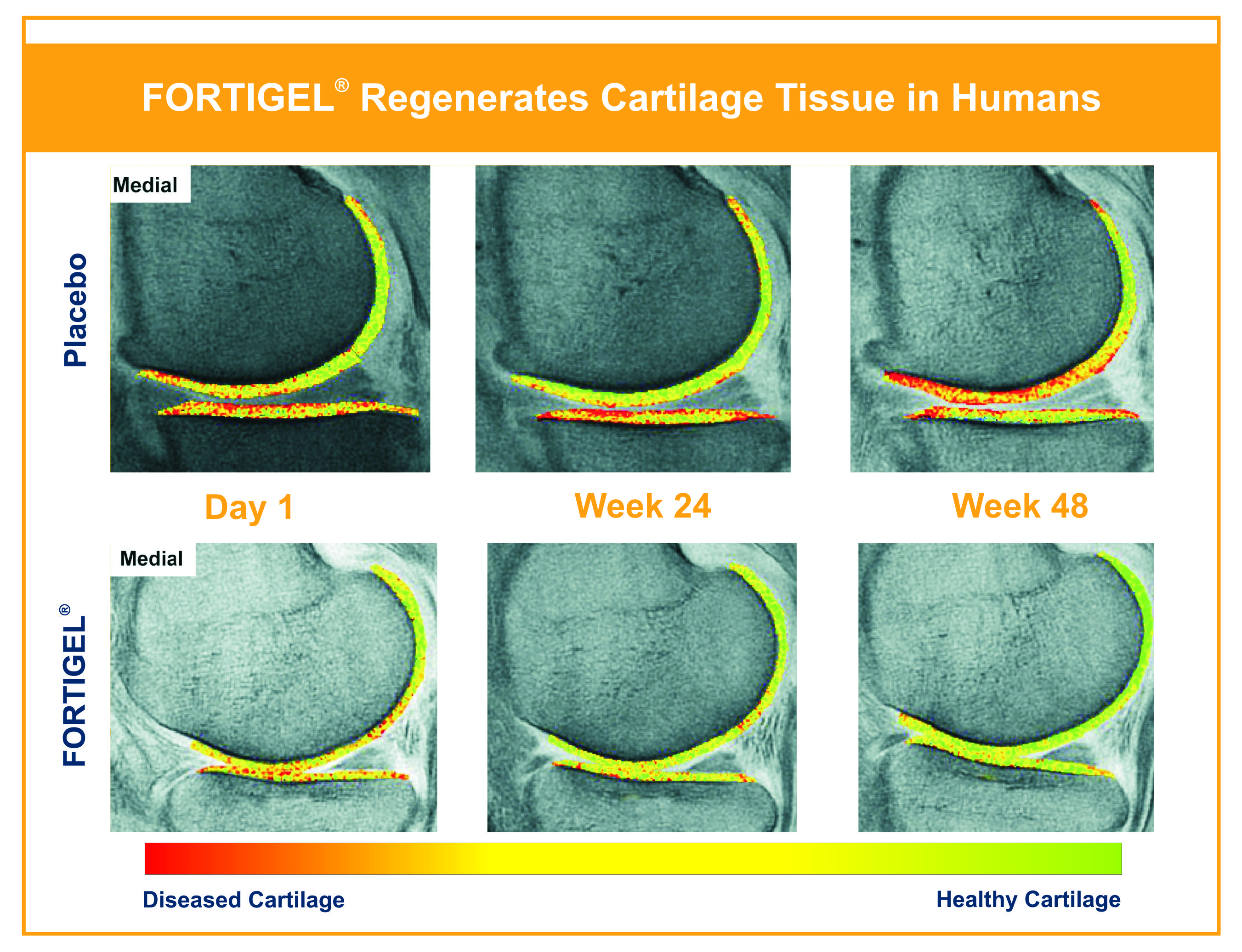 FORTIGEL® | Gelita